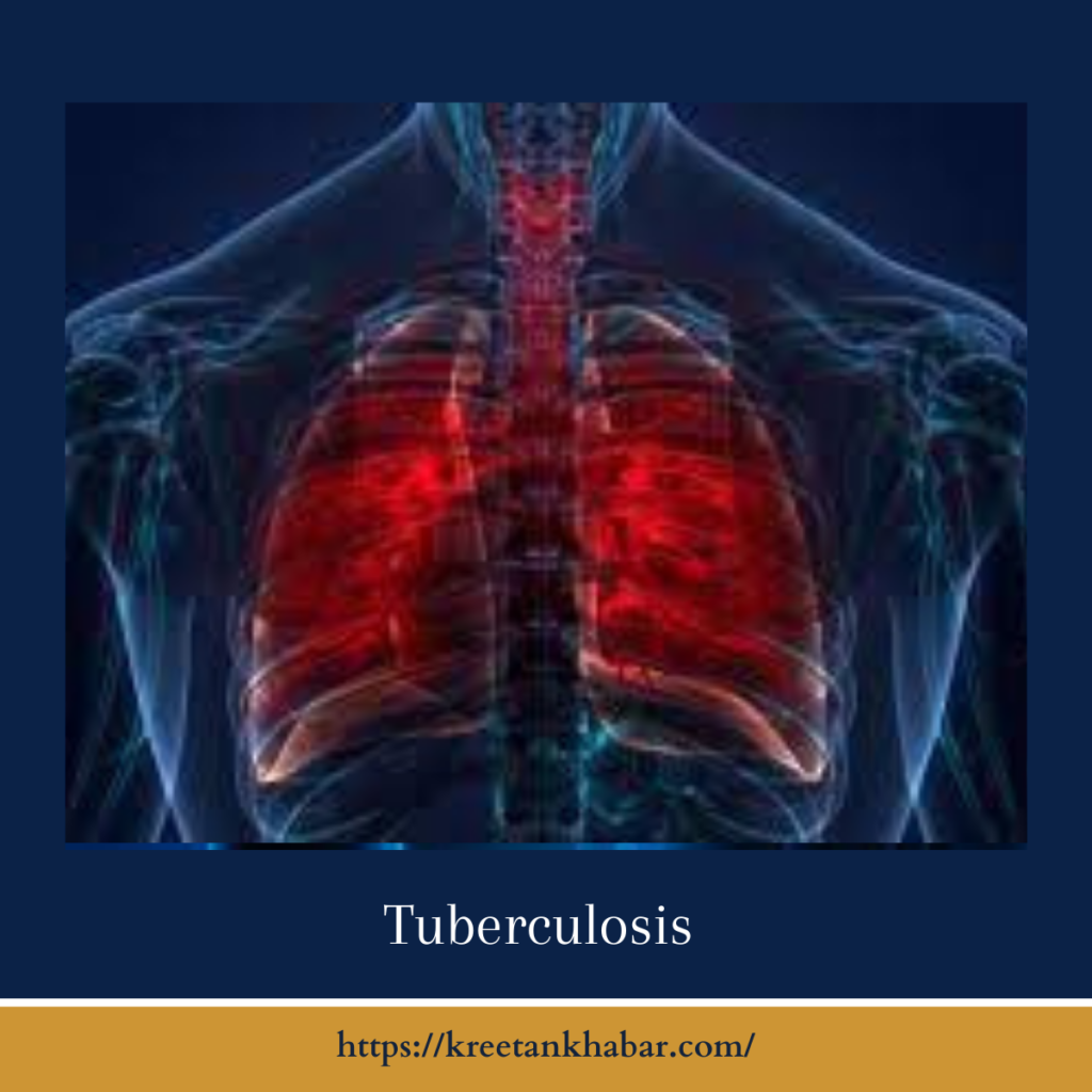 Tuberculosis 