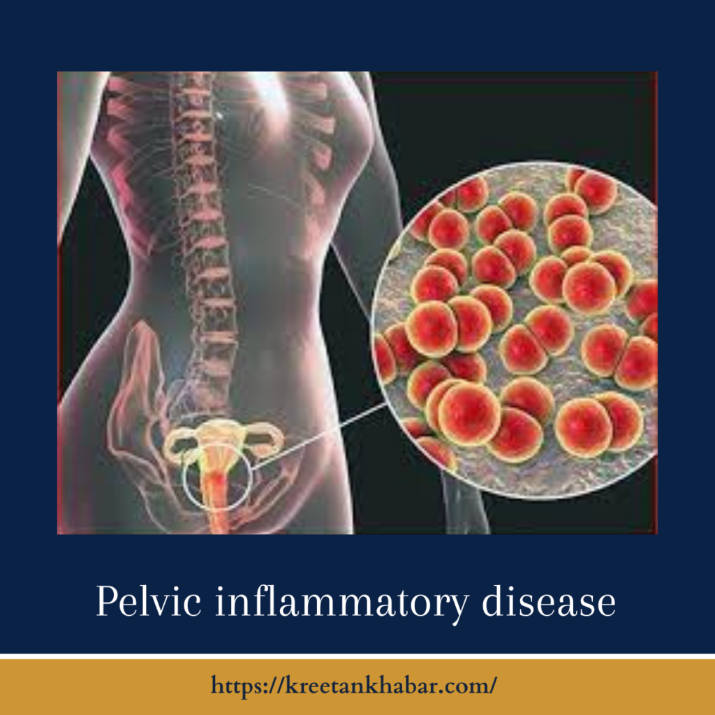 Pelvic inflammatory disease
