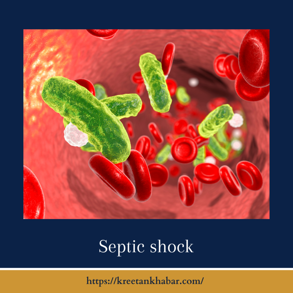 Septic shock
