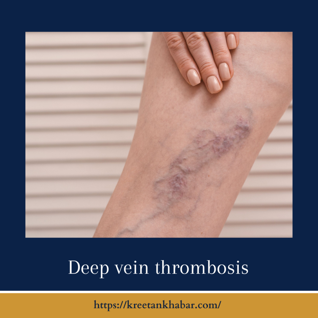 Deep vein thrombosis