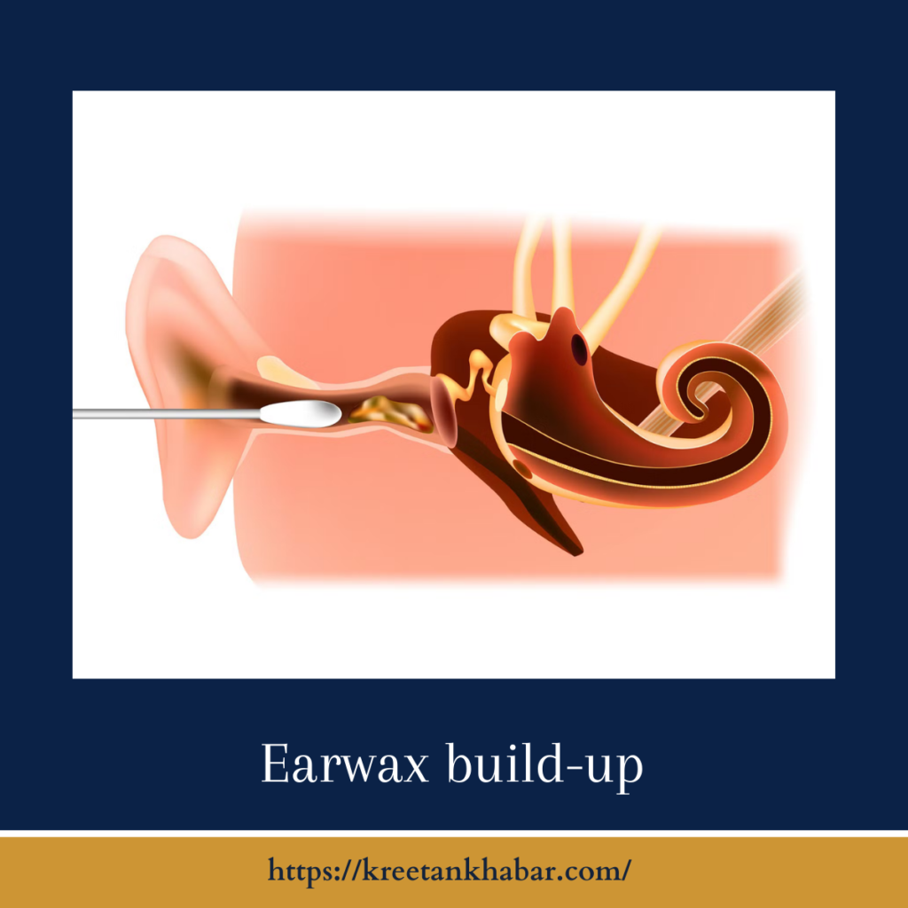 Earwax build-up
