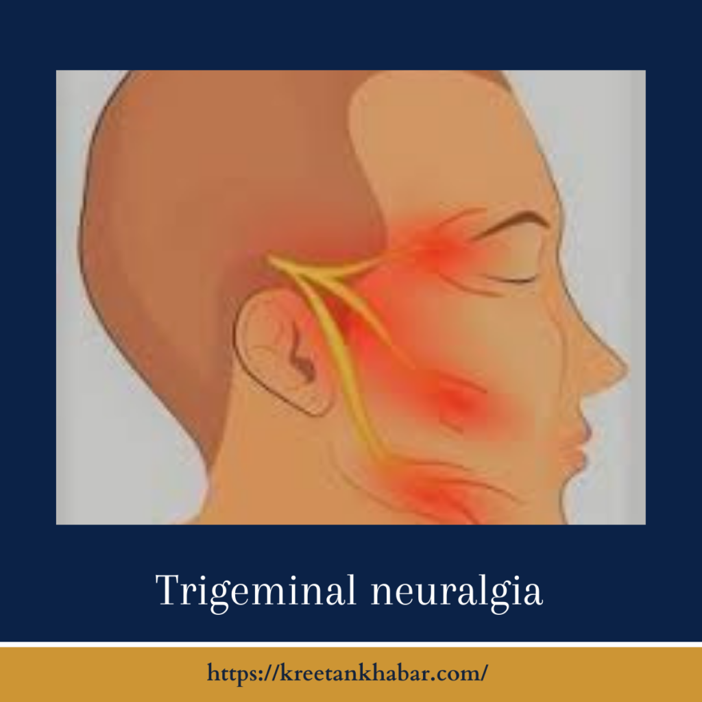 Trigeminal neuralgia
