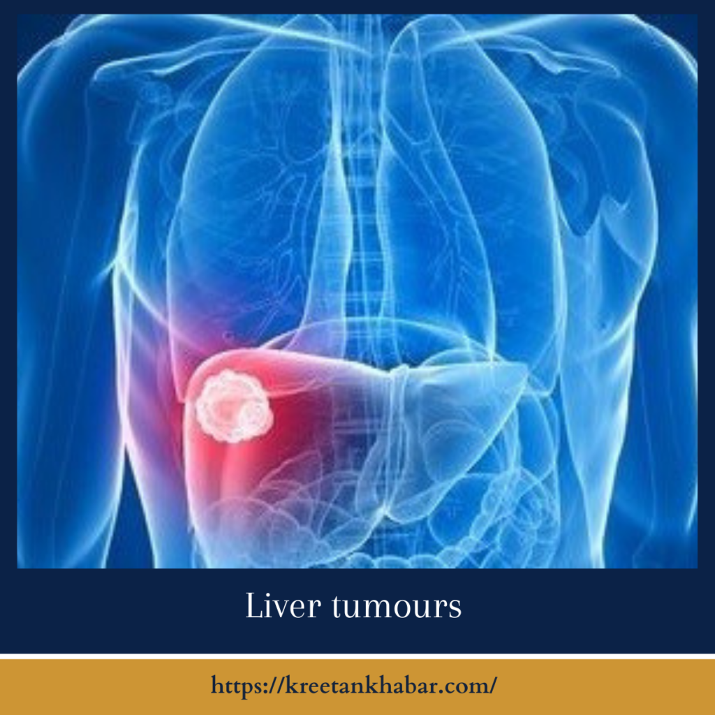 Liver tumours
