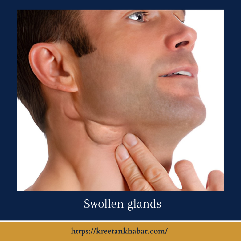 Swollen glands