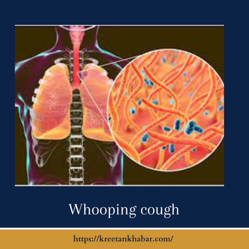 Whooping cough
