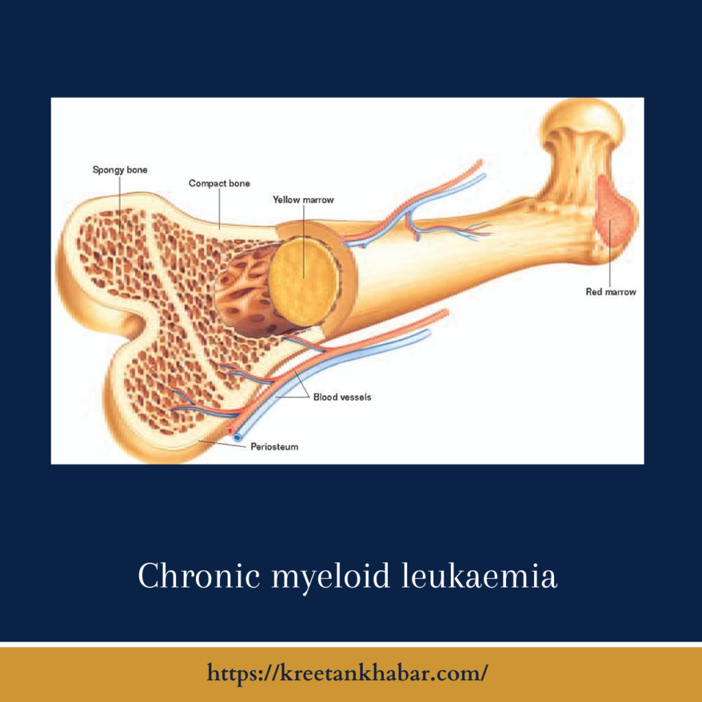Chronic Myeloid Leukemia (CML)