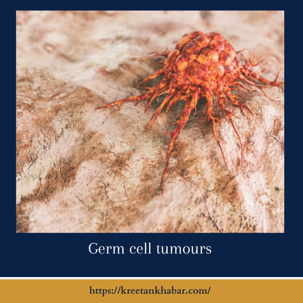 Germ cell tumours

