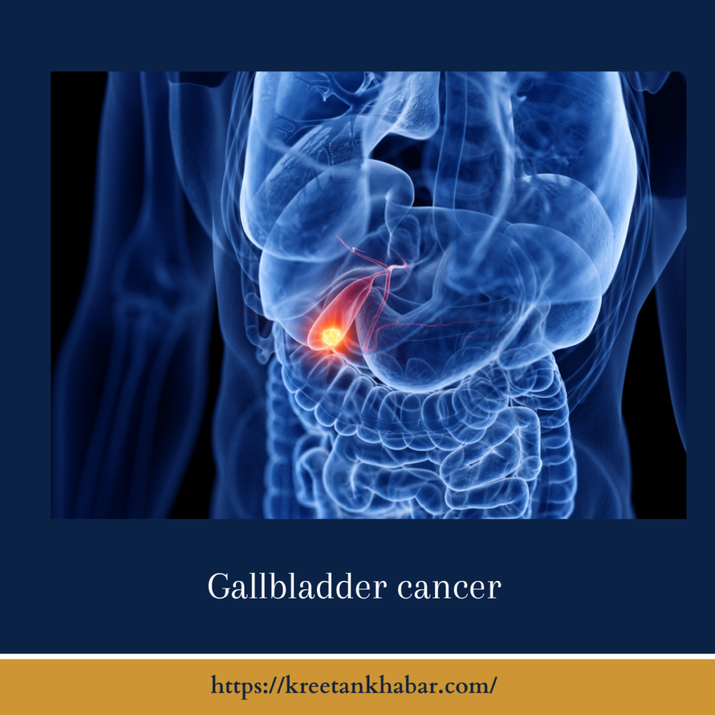 Gallbladder cancer
