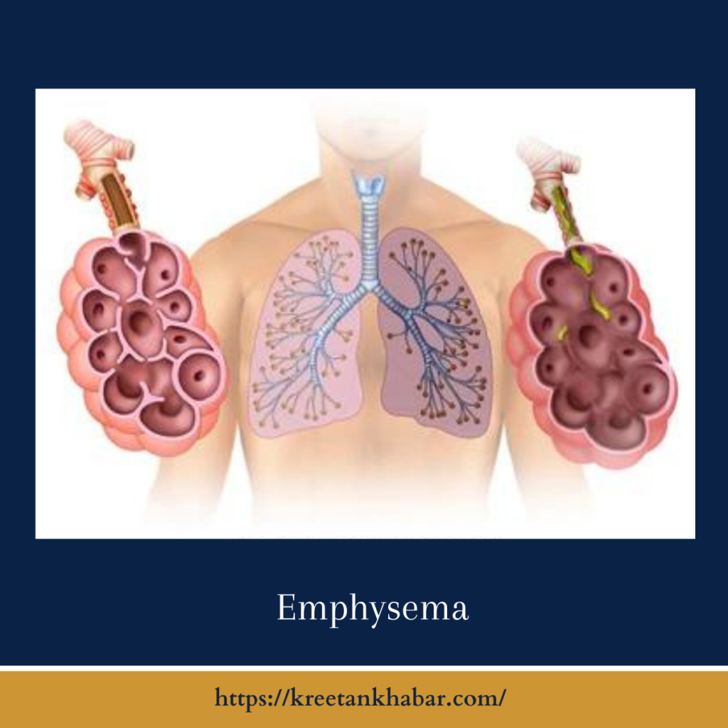 Emphysema