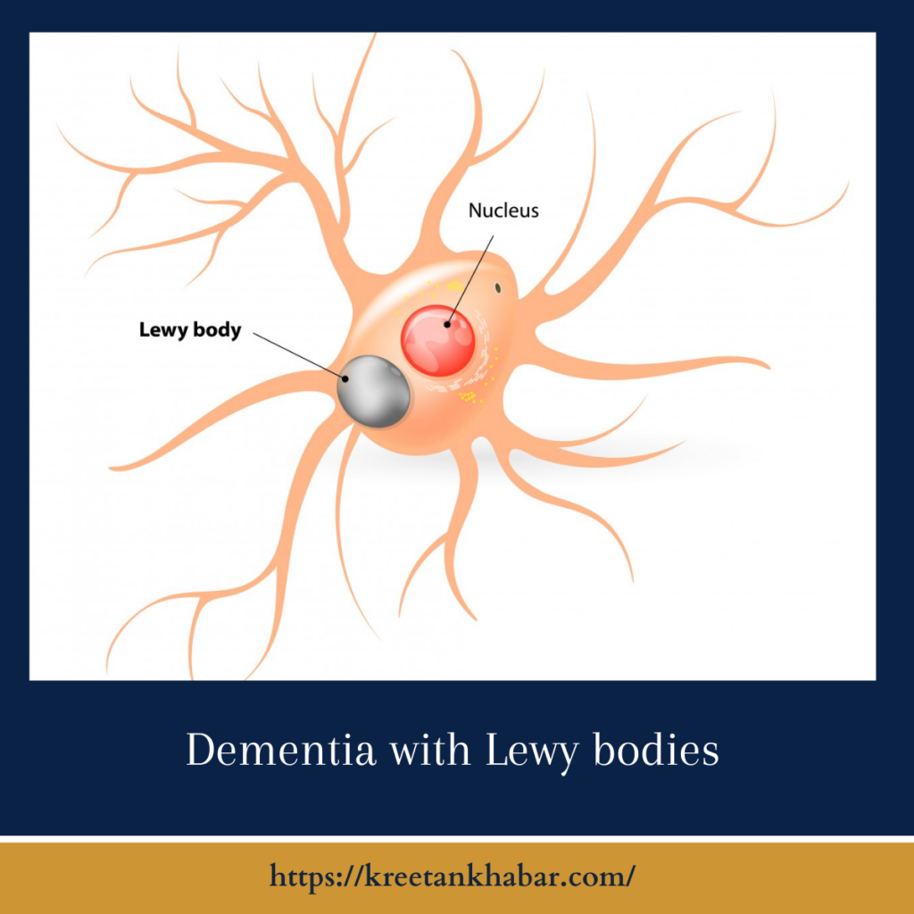 Dementia with Lewy Bodies