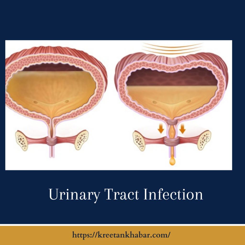 Urinary Incontinence