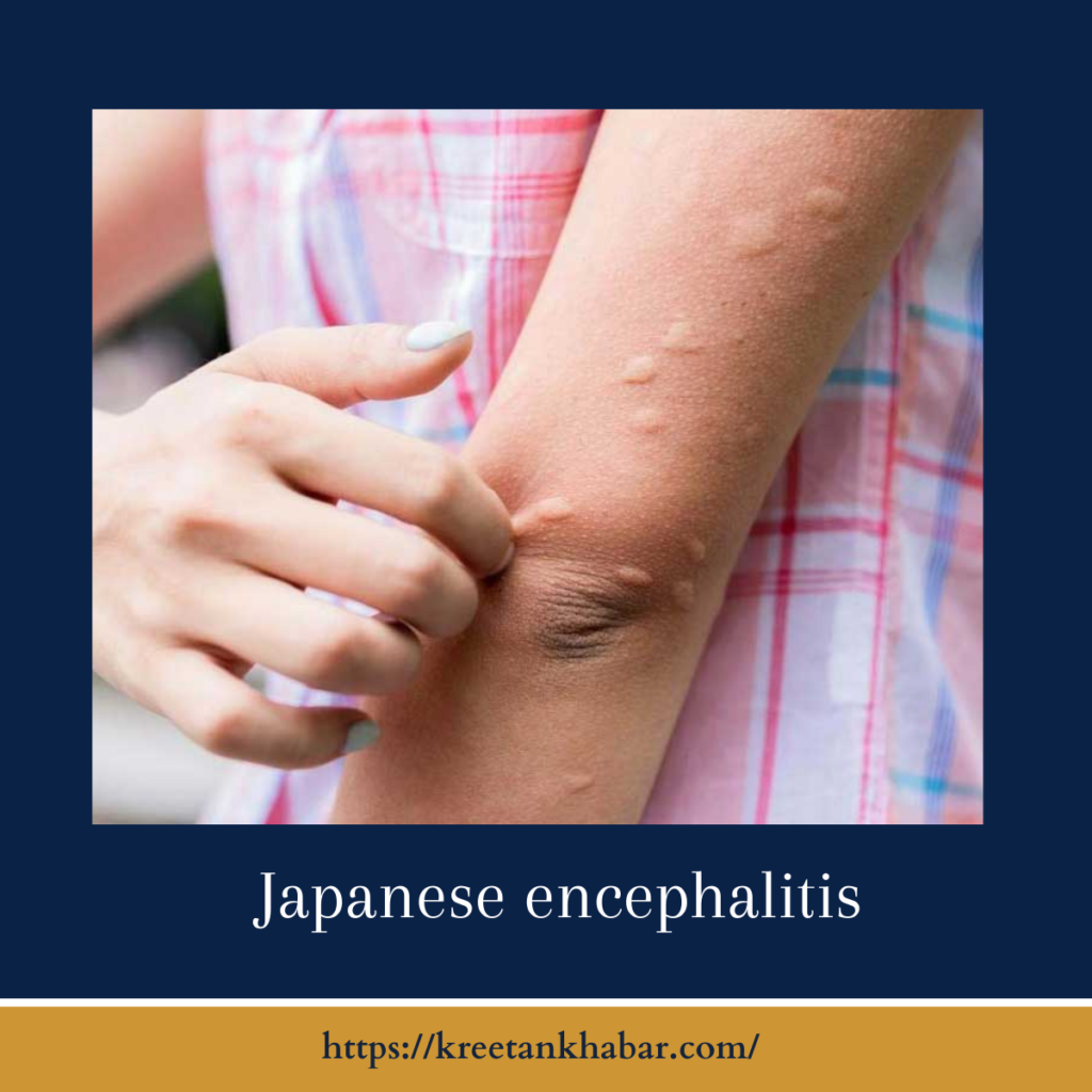 Japanese encephalitis