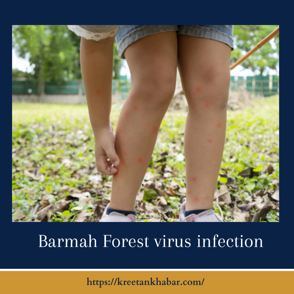 Barmah Forest Virus Infection