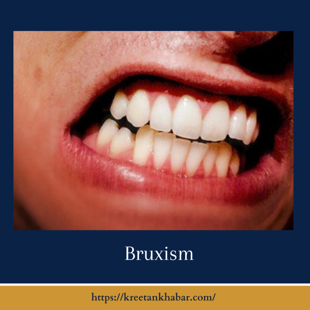 Bruxism