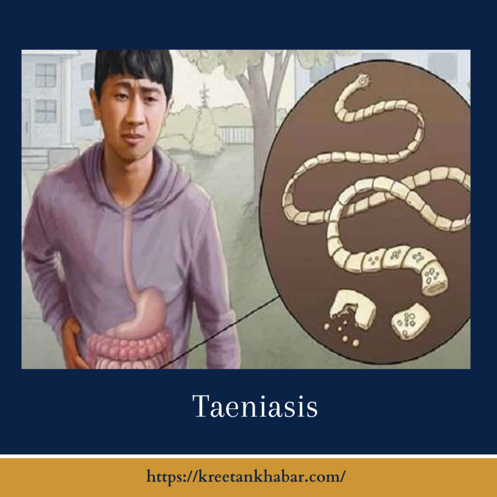 Taeniasis