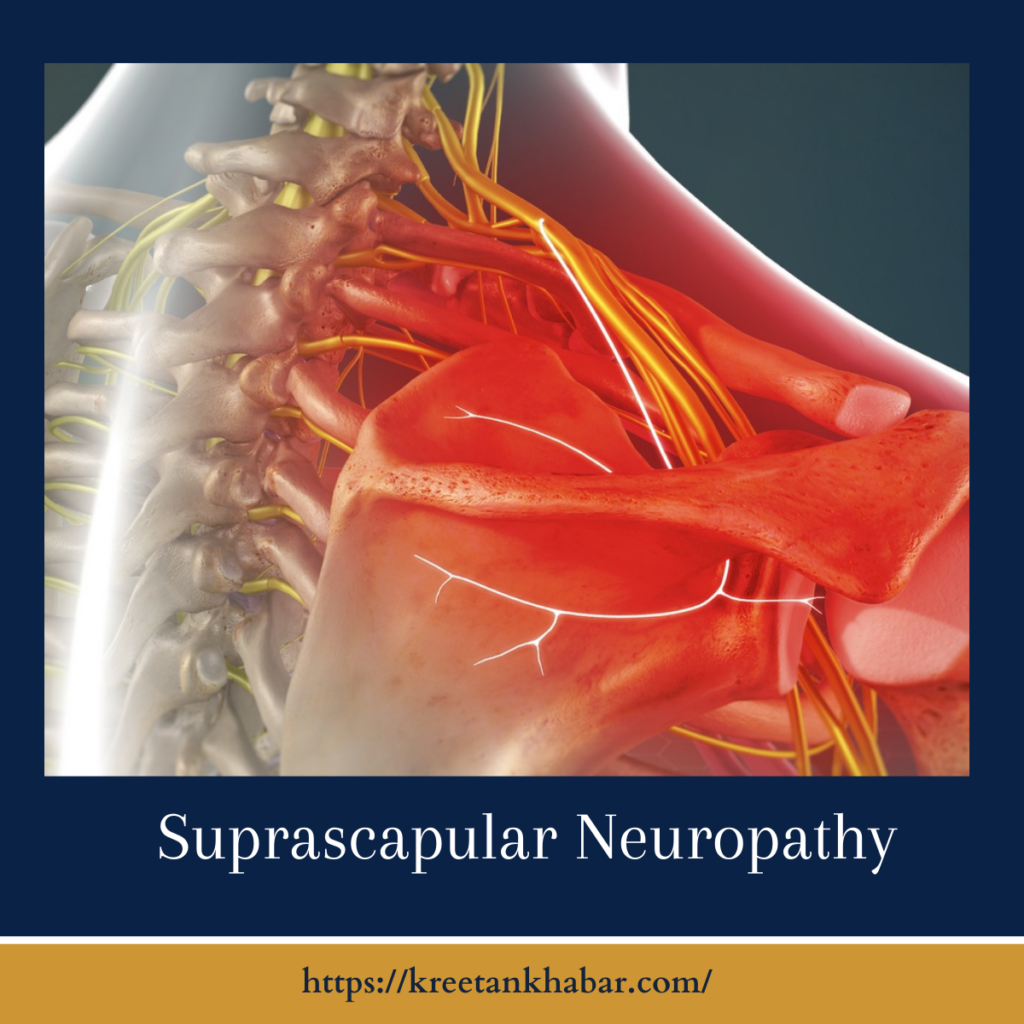 Suprascapular Neuropathy