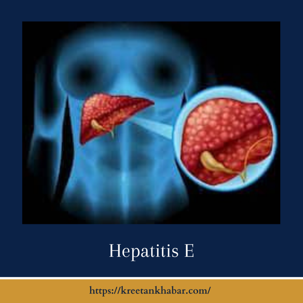 Hepatitis E