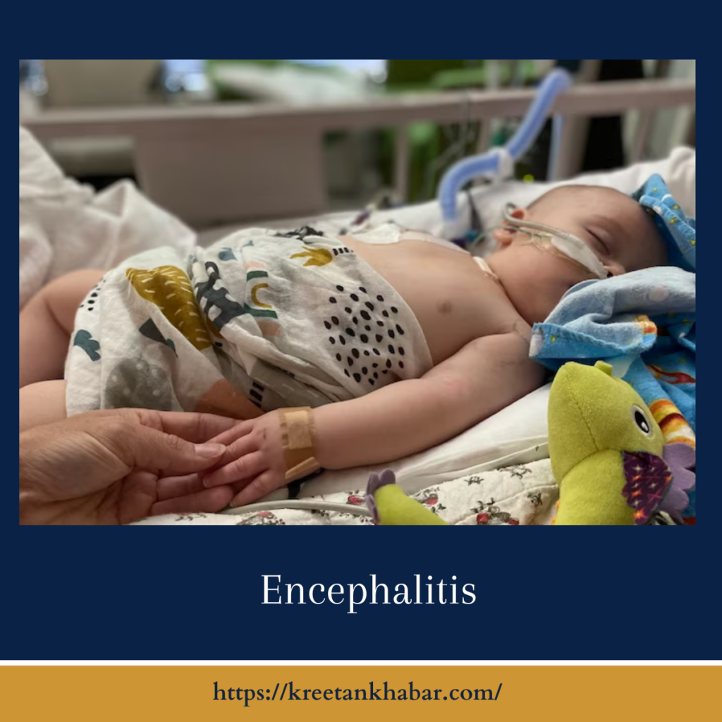 Encephalitis