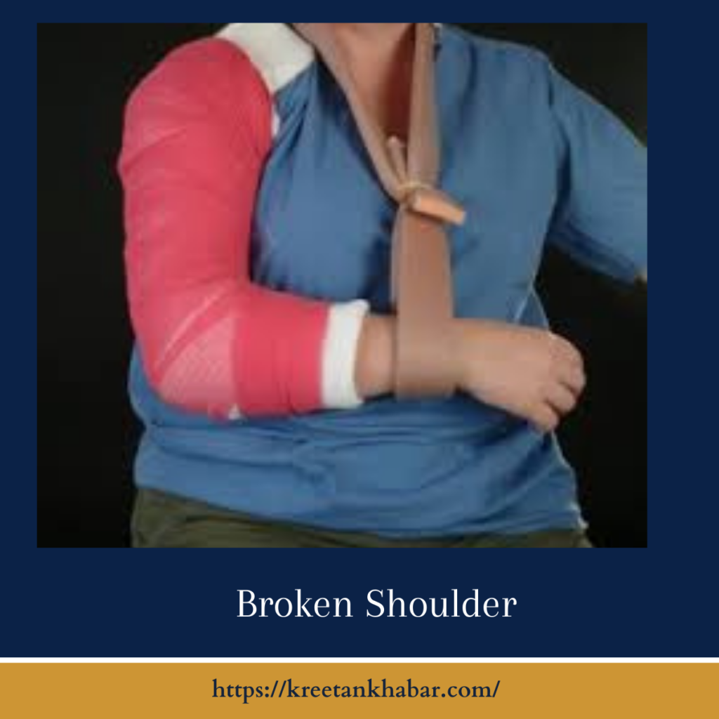 Broken Shoulder