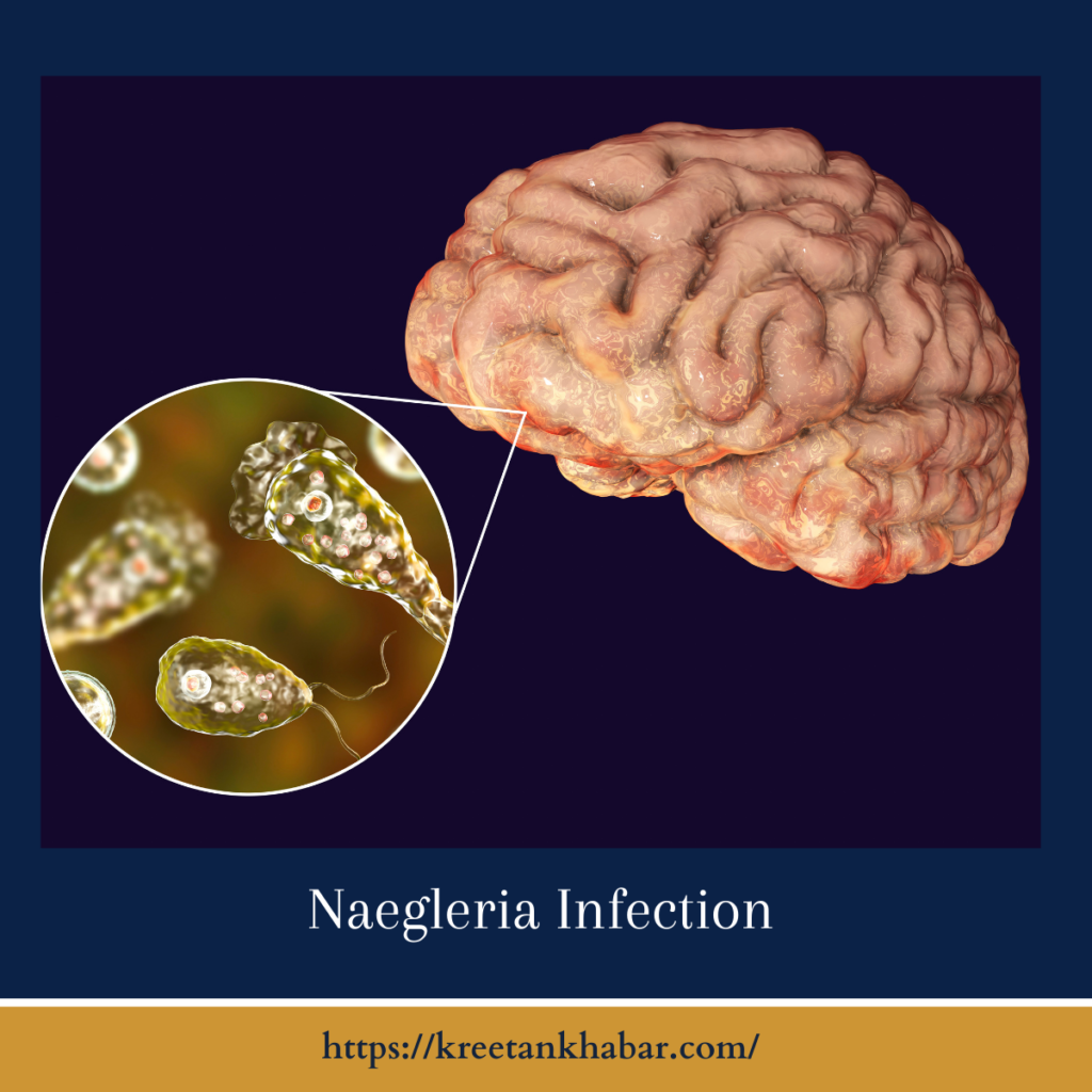 Naegleria Infection