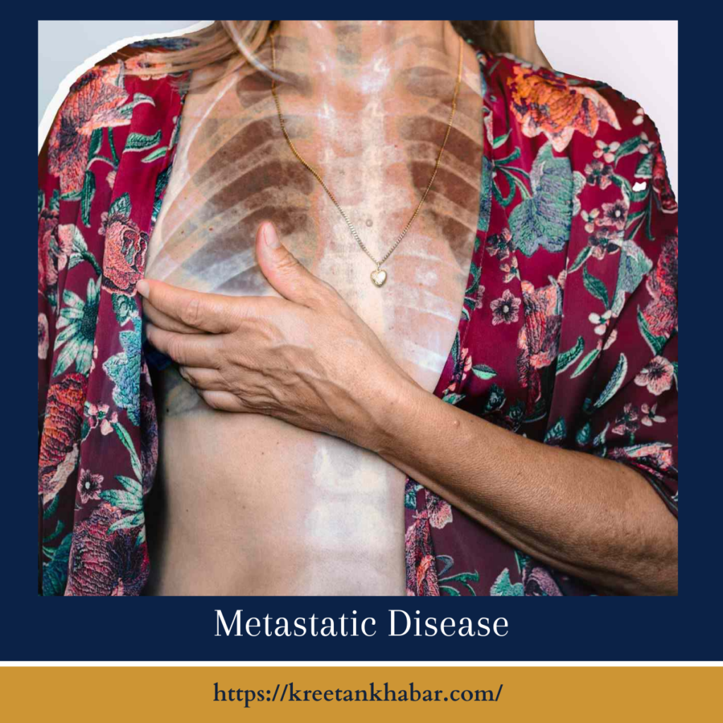 Metastatic Disease