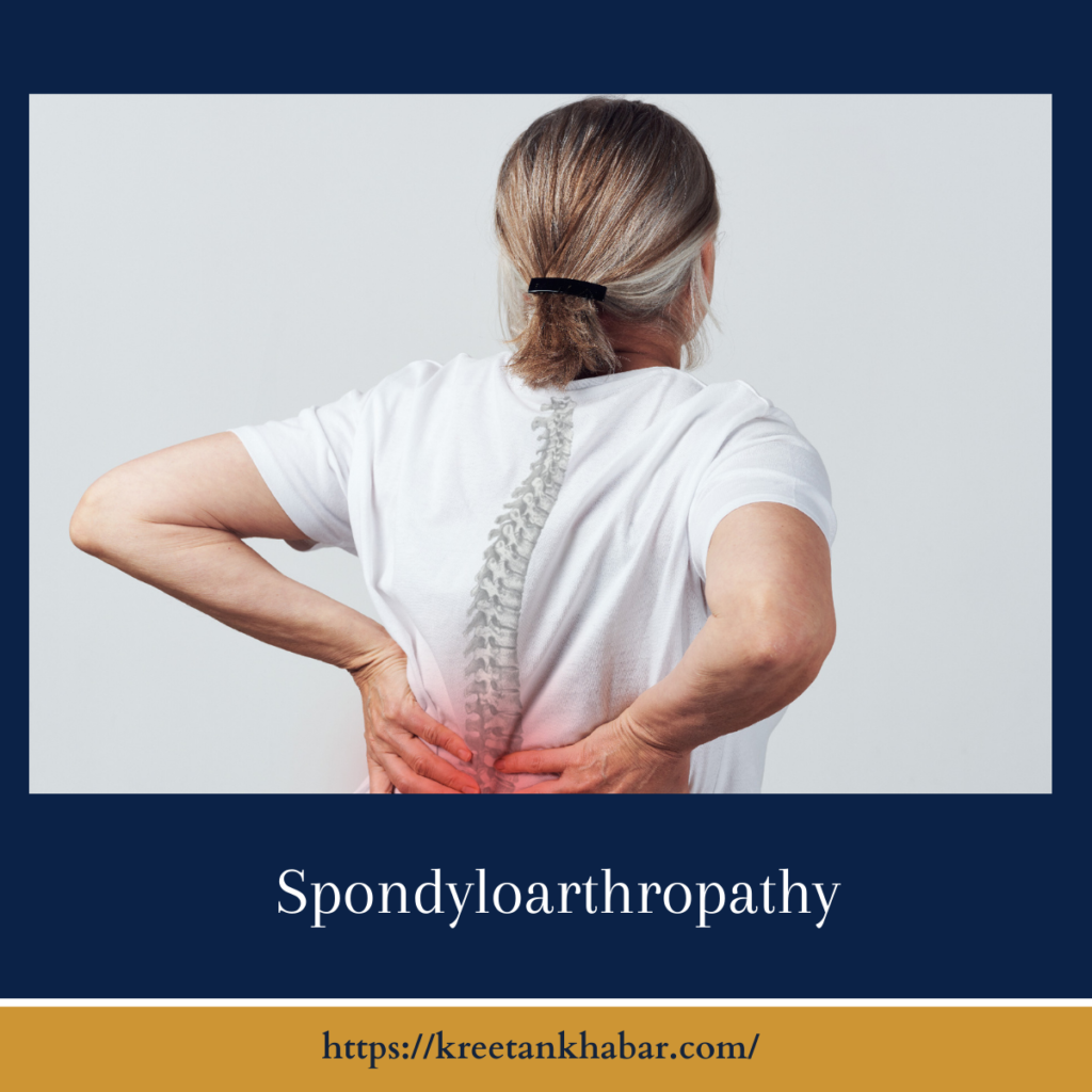 Spondyloarthropathy