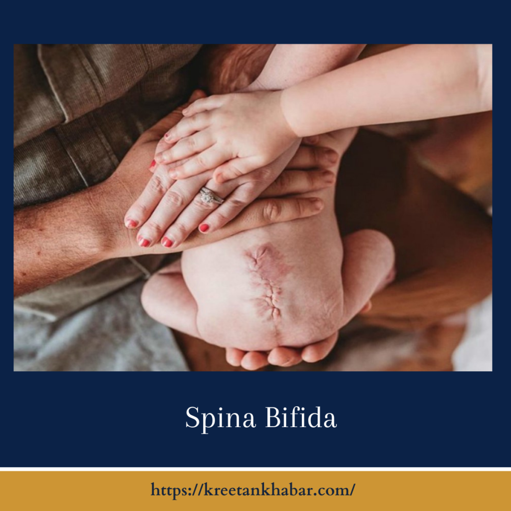 Spina Bifida