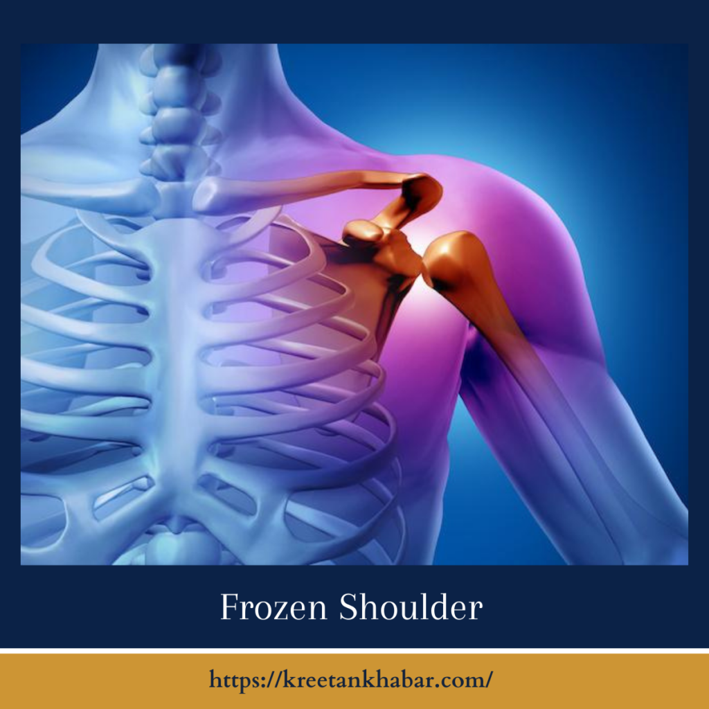 Frozen Shoulder