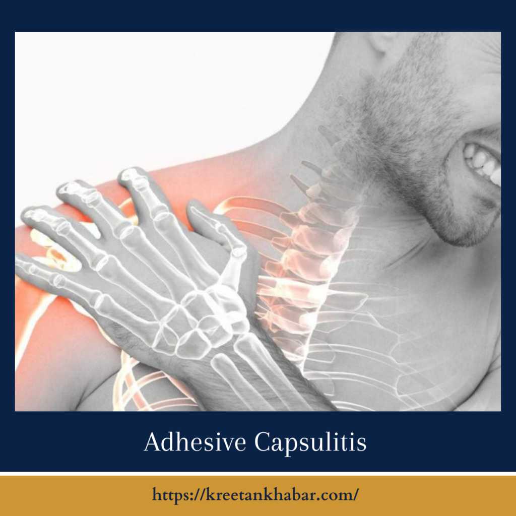 Adhesive Capsulitis