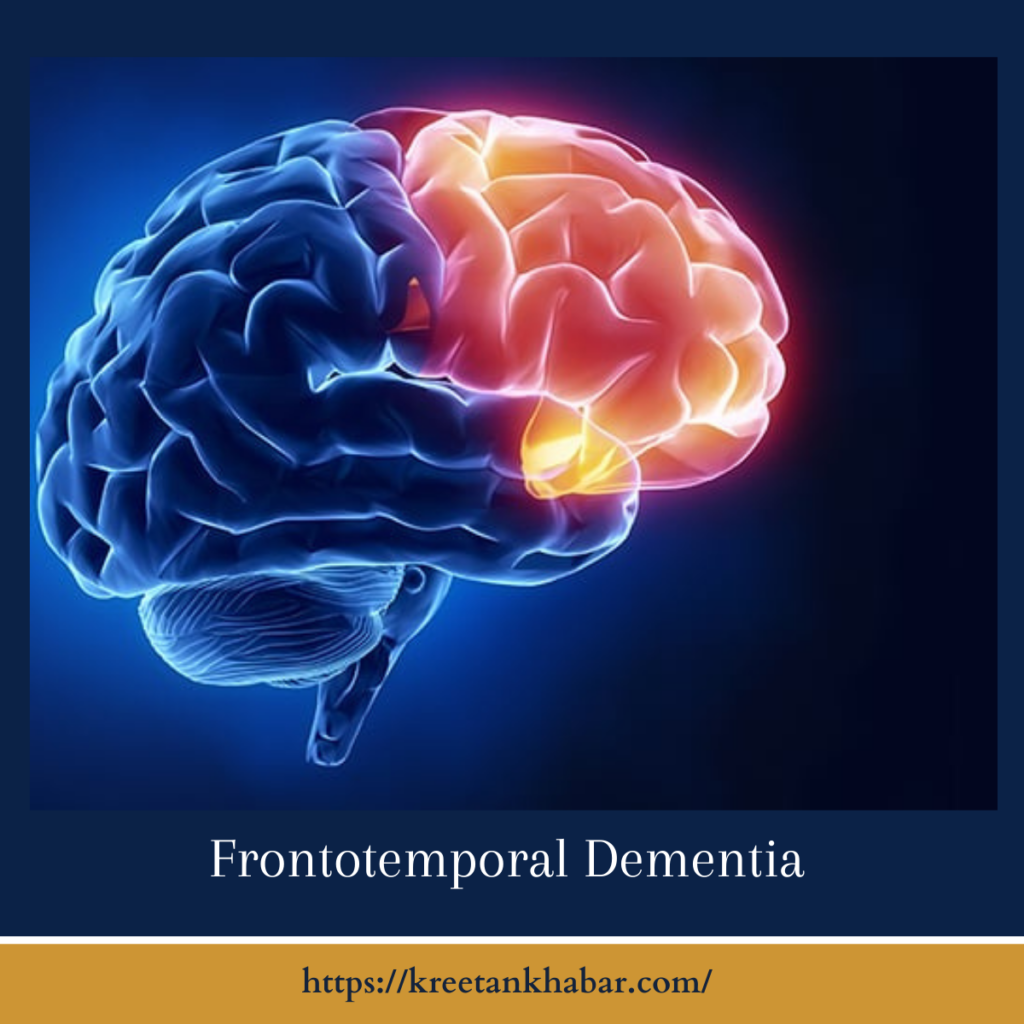 Frontotemporal Dementia