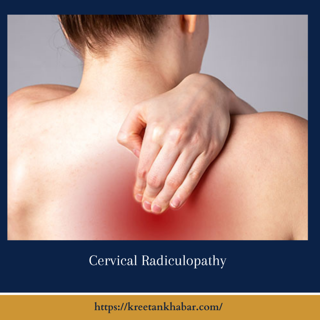 Cervical Radiculopathy