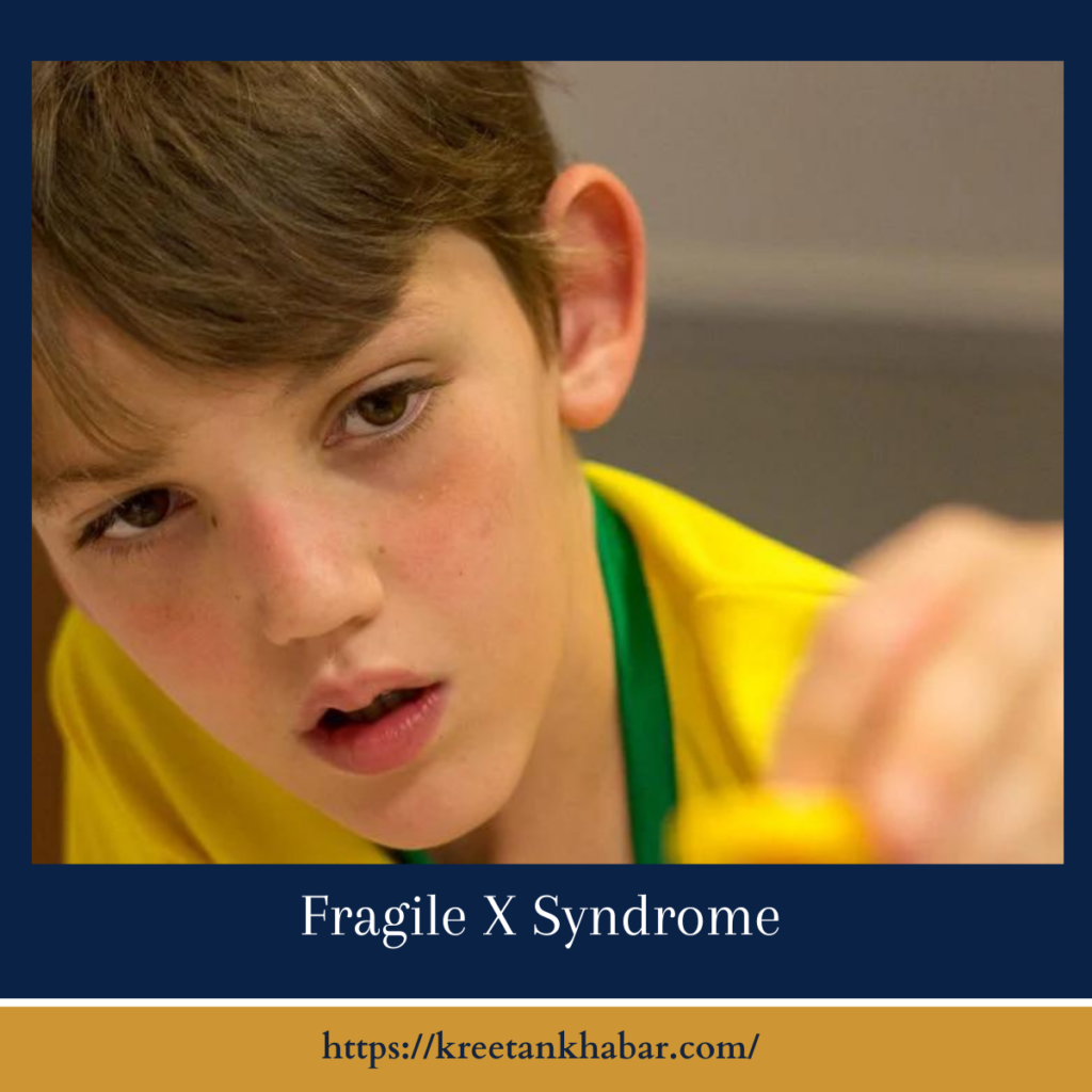 Fragile X Syndrome