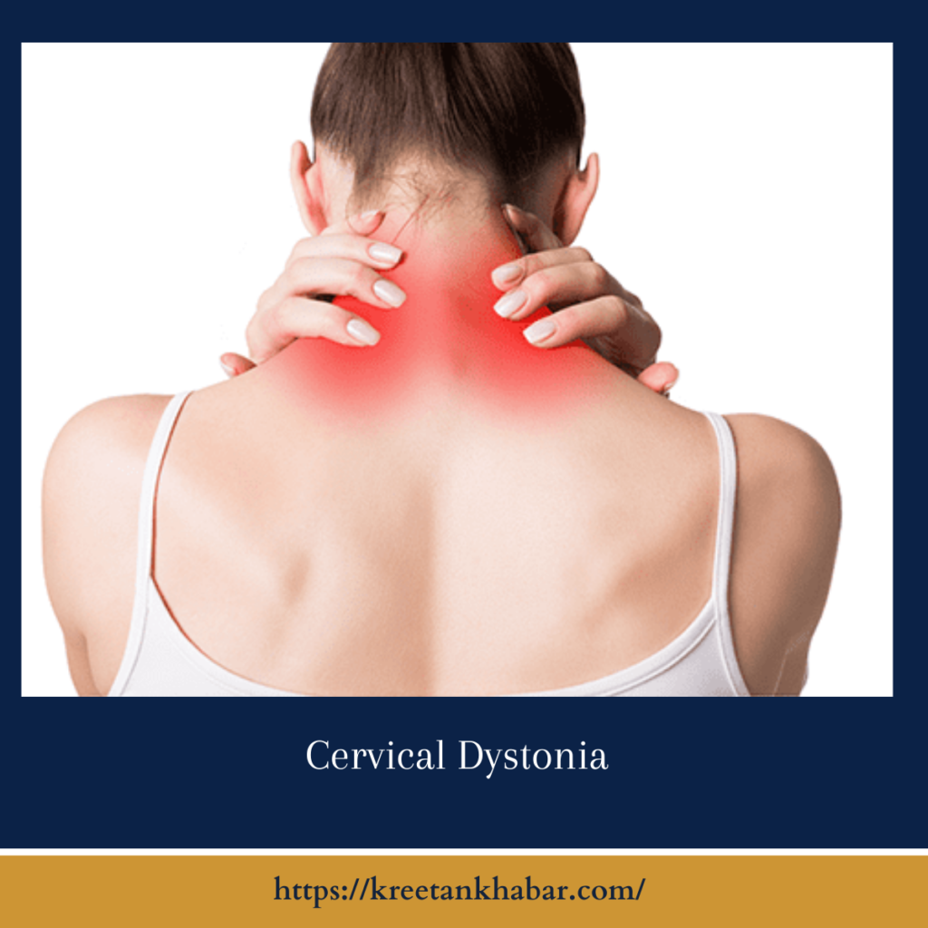 Cervical Dystonia