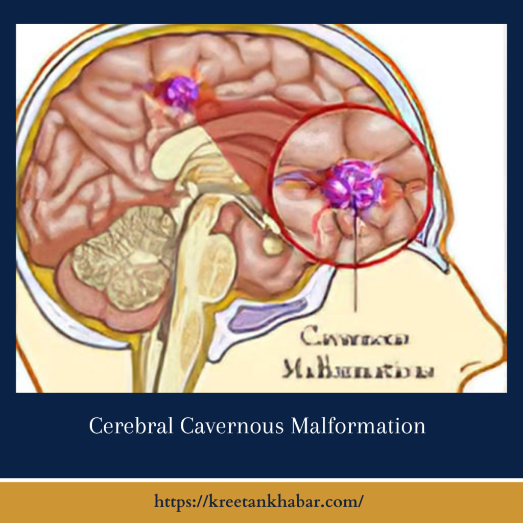 Cerebral Cavernous Malformation