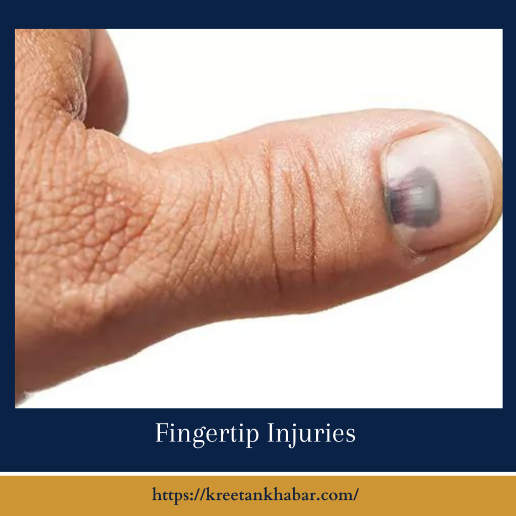 Fingertip Injuries