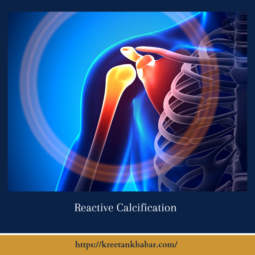 Reactive Calcification