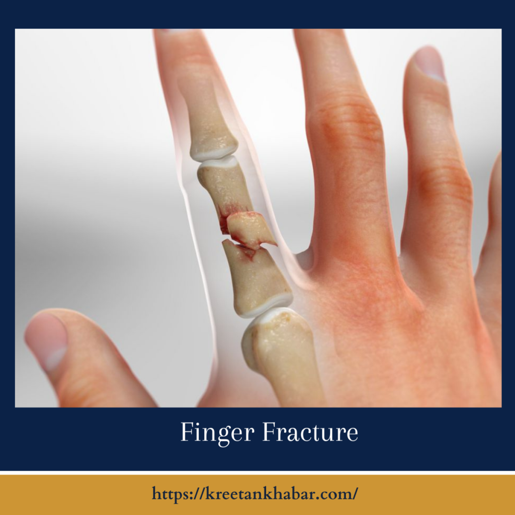 Finger Fracture