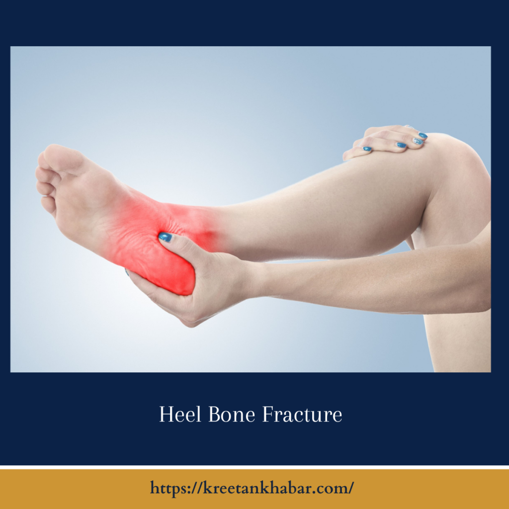 Heel Bone Fracture