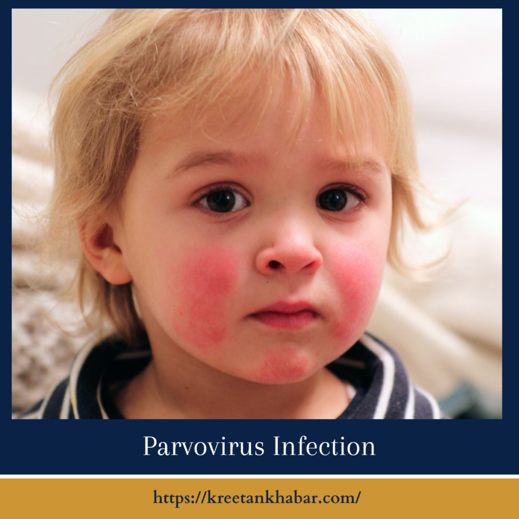 Parvovirus Infection