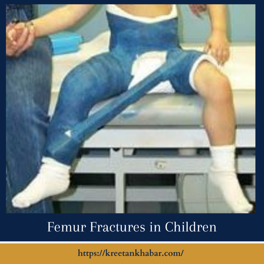 Femur Fractures in Children