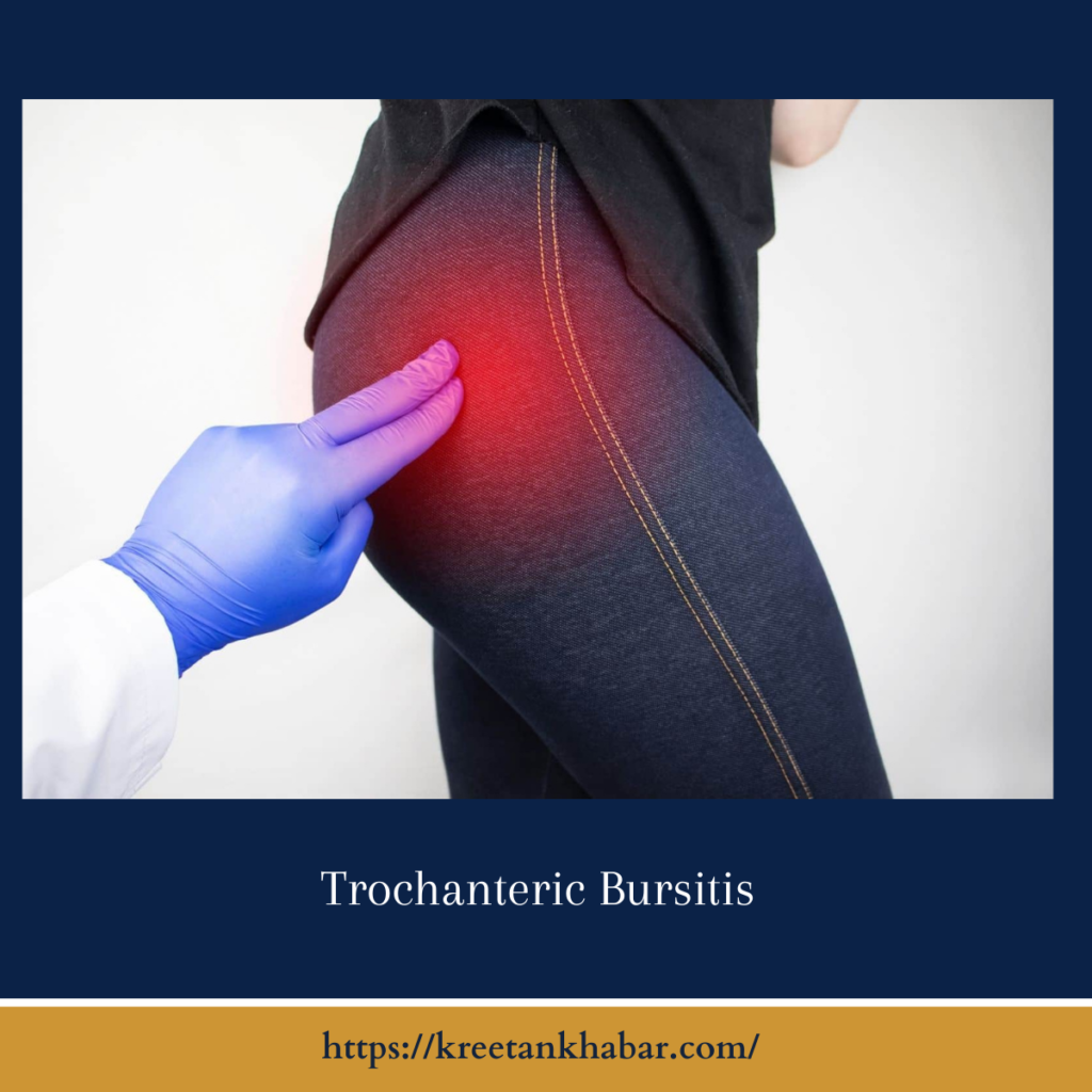 Trochanteric Bursitis