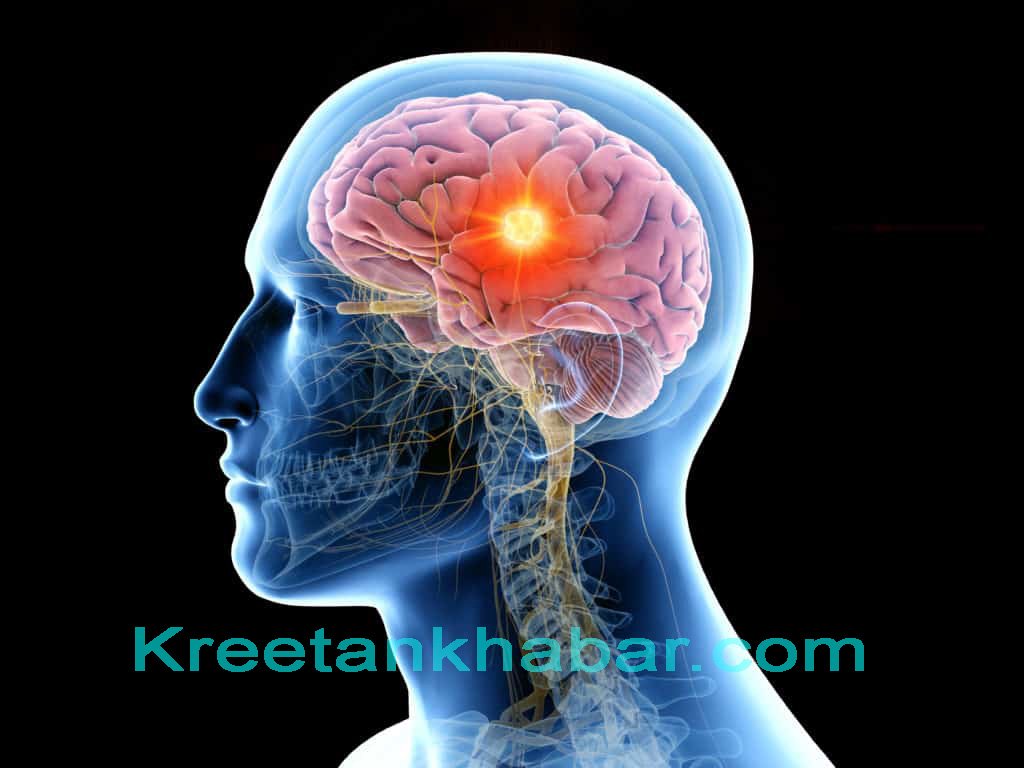 Brain Tumors Types, Causes, Risks And Treatments 2022