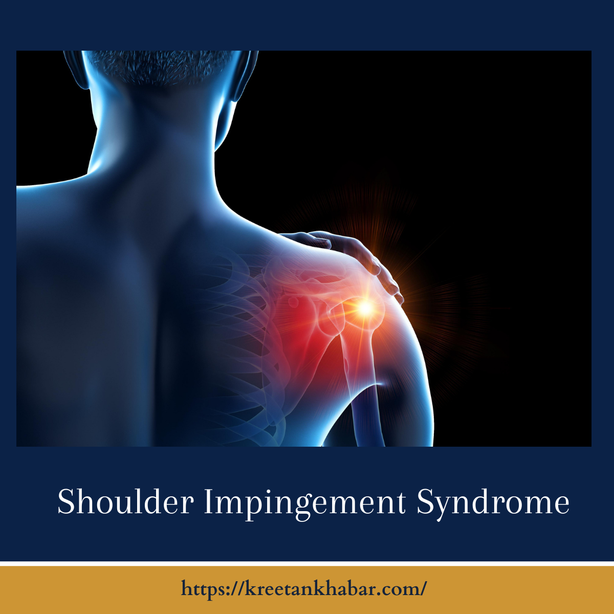 Shoulder Impingement Syndrome - Kreetan Khabar 2024