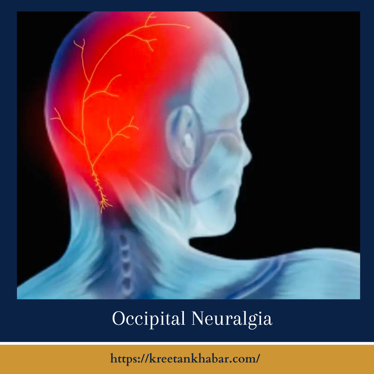 Occipital Neuralgia - Kreetan Khabar 2024